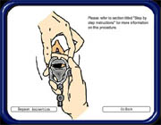 Cervical Cancer Courseware